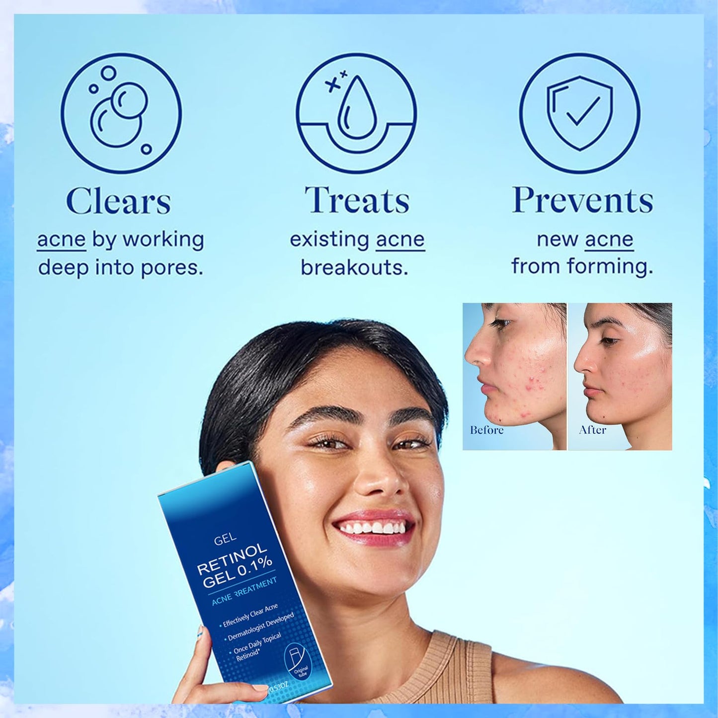 Retinol Gel,Retinol Acne Treatment Gel & Skin Soothing Cream,Retinol Moisturizer Cream,Spot Cre/am for Acne,Anti Acne G/el、