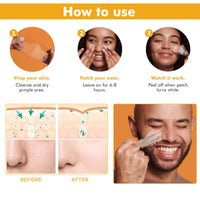 Generic Hydrocolloid Nose Strips for Blackhead Removal, Deep Cleansing Pore Strips to Absorb Oil and Dirt, Acne Treatment Patches for Nose, Invisible Spot Stickers for Men and Women (10 Count)