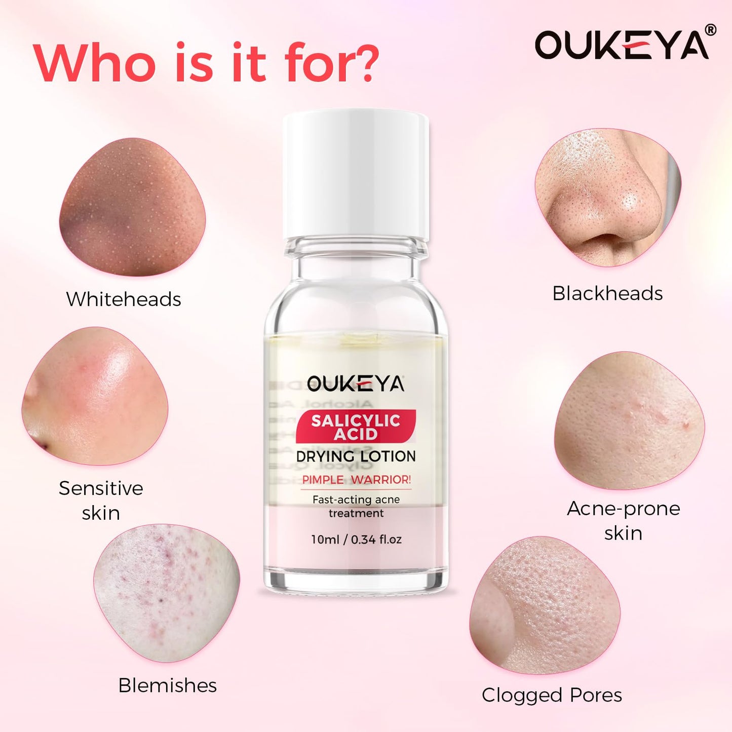 OUKEYA Spot Drying Lotion for Spots 2 x 10ml, Acne Care for Face with Salicylic Acid & Niacinamide, Oil Balancing, Pore Refining, for Acne-Prone and Oily Skin