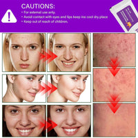 Night Cream Face Moisturiser, Azelaic Acid 12% Facial Serum Cream,Dark Spot Serum Cream for Face,Skincare with Niacinamide & Vitamin C,Beauty Products for Rosacea,Acne,Balance Excess Sebum