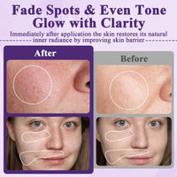 2 PCS Advanced Anti-Hyperpigmentation Cream, Pigmentation Removal Cream Face for Hyperpigmentation, Tightens Skin Suitable for All Skin Types