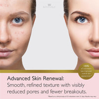 Revitale Advanced Salicylic Acid Cream for Face & Body 80g – Helps Smooth & Soften Skin Texture. For Rough, Bumpy & Blemish-Prone Skin