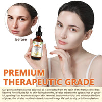 LEISGOTO Frankincense Oil for Skin, 100% Pure and Natural Organic Frankincense Oil for Self Care, Skin, Face, Hair, Relieving Discomfort, Calming, Massage & Relaxation | 60ml