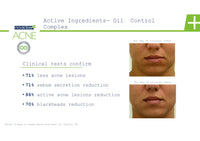 Novaclear Acne kit, Breakout Fighting Bestsellers-Facial acne set, Exfoliating & Treatment-Reduce Blemishes, Enlarged Pores & Blackheads - with Salicylic, Azelaic Acid and Tea Tree - All Skin Types