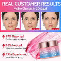 MASAIGGE Collagen Jelly Cream, Collagen Gel Face Cream with Niacinamide & Hydrolyzed Collagene, Anti-Aging Face Moisturiser, Deep Hydrating, Revitalise Dull Skin, Boosts Skin's Barrier Hydration & Glow