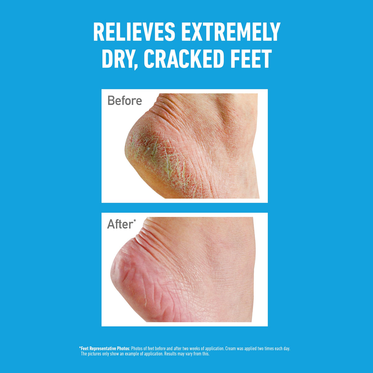 O'Keeffe's Healthy Feet 80ml (5 Pack)