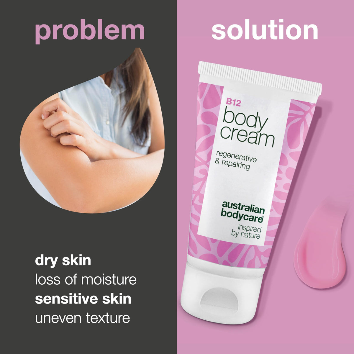 Australian Bodycare Hydrating Vitamin B12 Body Cream – Intensive Care for Dry & Irritated Skin | Protects & Softens | Perfect for Sensitive Skin | With Ectoin & Allantoin