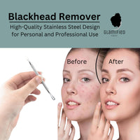 Glamified , glam Glamified Blackhead Remover Professional Skincare Spot Treatment Blackhead Remover Tool for Blemish Comedone Whiteheads Pimple Popper with Double Sided Soft Touch and Anti-Slip Design