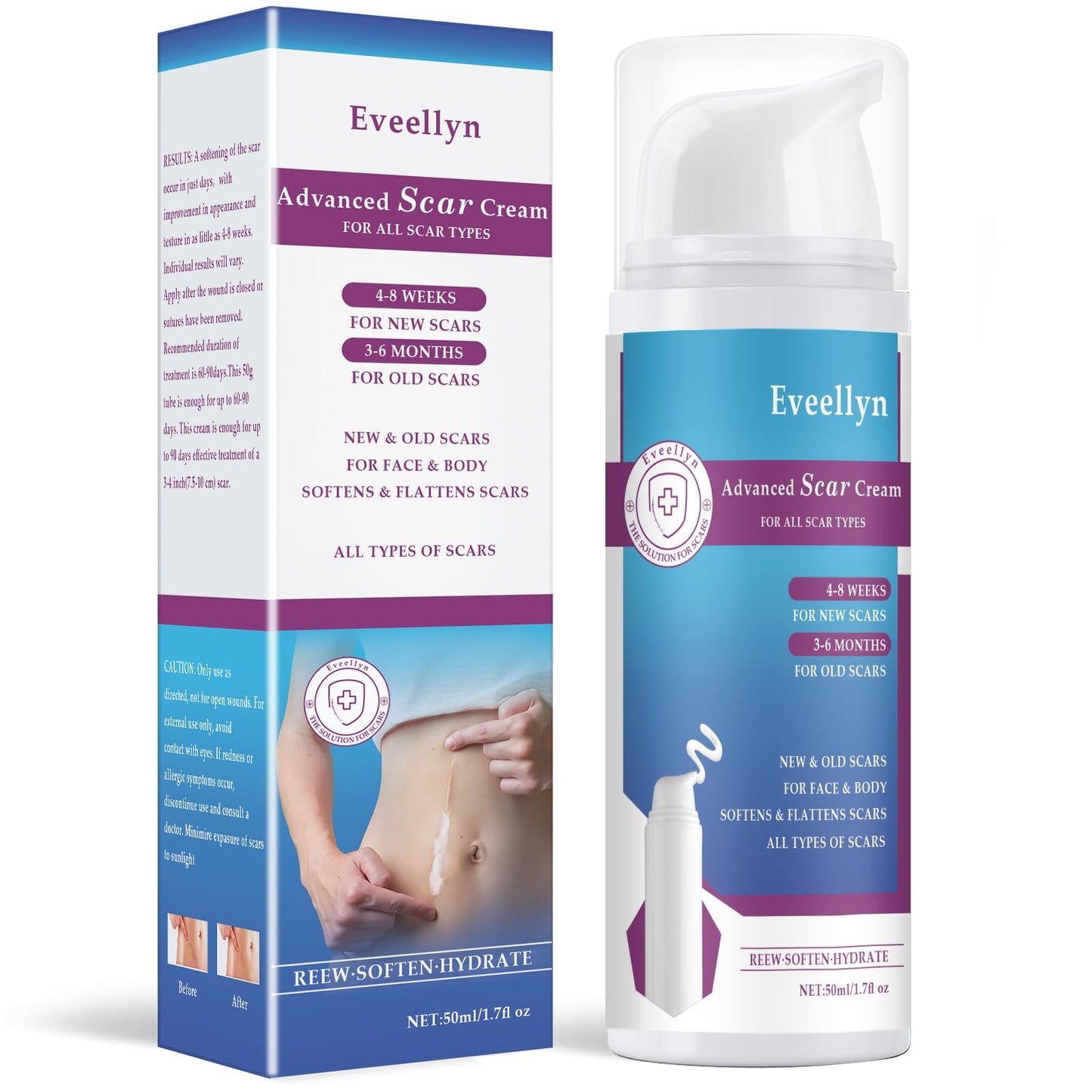 Eveellyn Scar Cream, Scar Gel, Professional Scar Removal Cream for Surgical Scars, Stretch Mark, Keloid Bump, C-Section, Burn, Acne, Old and New Scars 1.7 oz (50g)