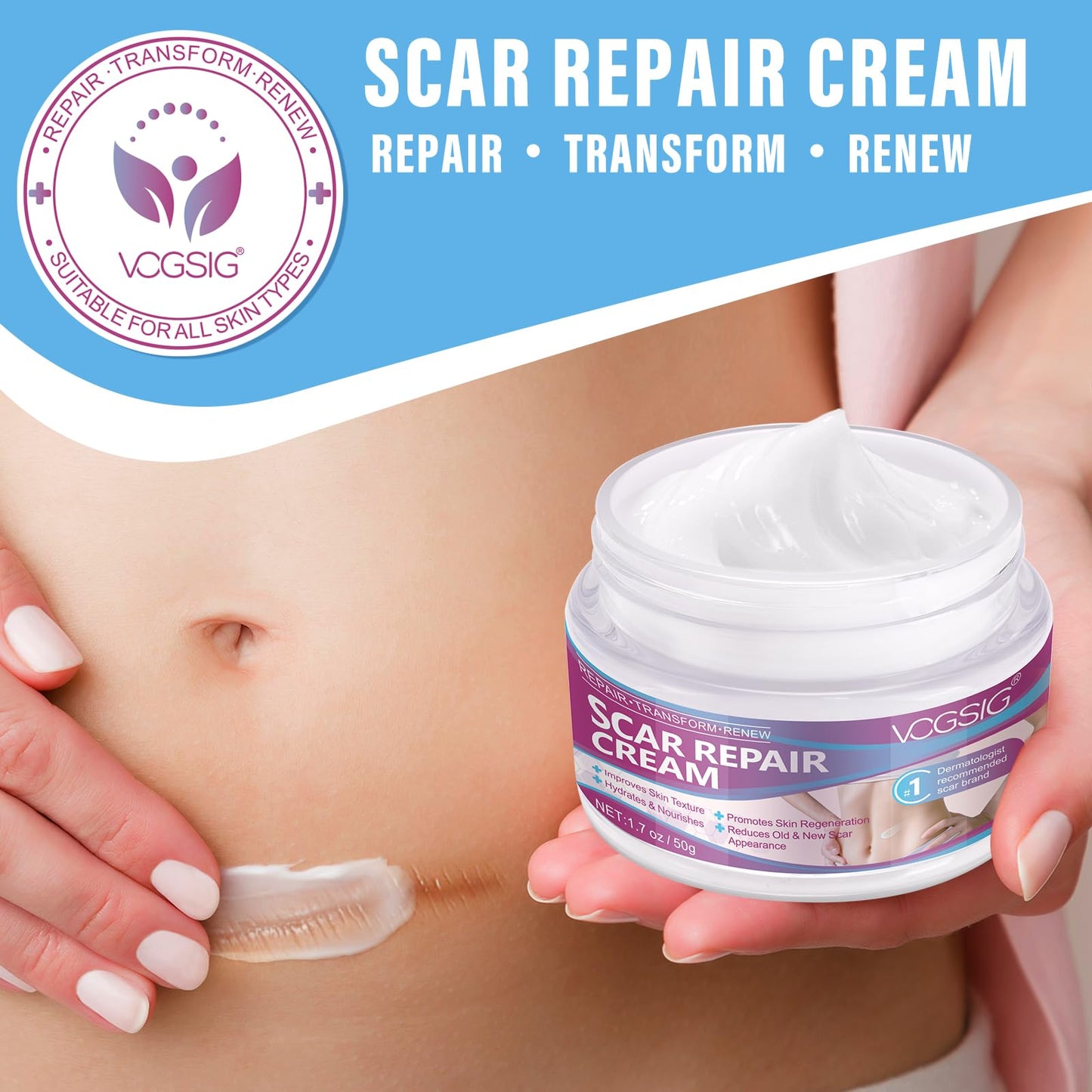 mysemgshuo 50g Advanced Scar Gel Cream, Scar Repair Cream, Scar Removal,Scar Treatment, Scar Removal Cream for C-Section, Stretch Marks, Acne, Effective for Both Old and New Scars