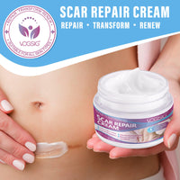 mysemgshuo 50g Advanced Scar Gel Cream, Scar Repair Cream, Scar Removal,Scar Treatment, Scar Removal Cream for C-Section, Stretch Marks, Acne, Effective for Both Old and New Scars