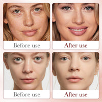 Dragon Blood Easy Serum,Dragons Blood Anti Aging Serum,Retinol Placenta Dragon Blood Serum,Dragons Blood Easy Serum Liquid,Dragon Blood Serum,Dragon's Blood Facial Anti-Wrinkle Serum