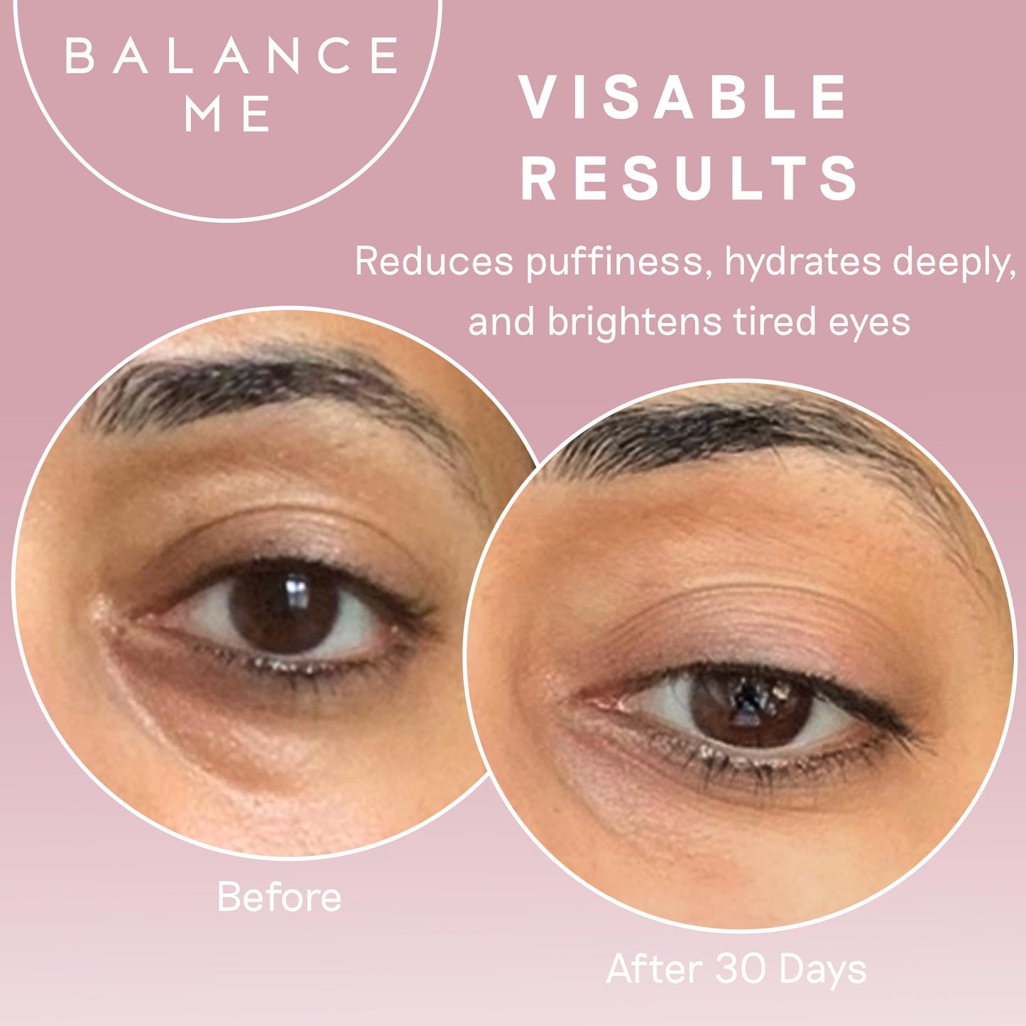Balance Me Wonder Eye Cream 15ml, Under Eye Brightener Treatment for All Skin Types, Hydrating & Firming, Anti-Aging, Brightens & Smooths Under Eyes Best Anti Aging Eye Cream