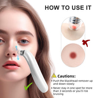 GUPAY Blackhead Remover Vacuum, Pore Vacuum with 1080p HD Camera Visible Facial Pore Cleanser with 4 Suction Heads, 5 Suction Power for Pimple Acne Whitehead Deep Cleansing Remover Tool