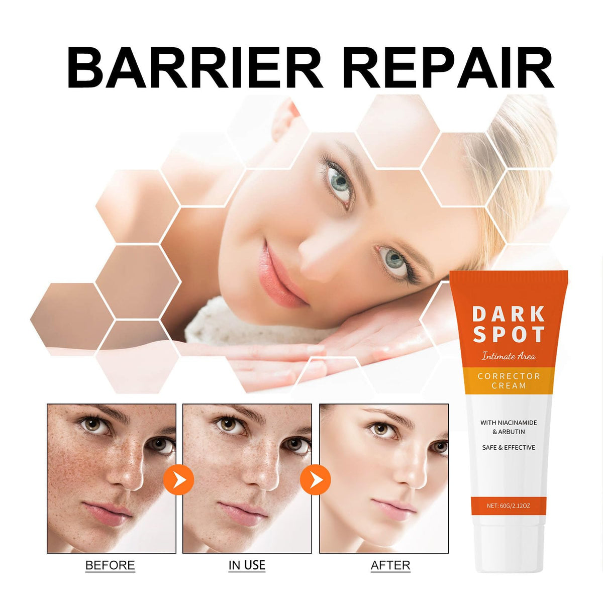 OKAQEE Dark Spot Corrector for Face and Body - Intimate Areas Spot Cream with Niacinamide - Dark Spot Remover for Face - Freckle Removal Cream for Women - Improve Skin Dullness, Fade Spots Blemishes - 60g