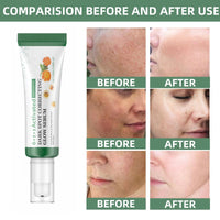 Siyinzu Dark Spot Correcting Glow Serum with 5% Niacinamide,Niacinamide Serum,Dark Spot Remover for Face,Skin Brightening Serums to Even Skin Tone,Dark Spots Correcting Serums,Face Serums Women,Facial Cream