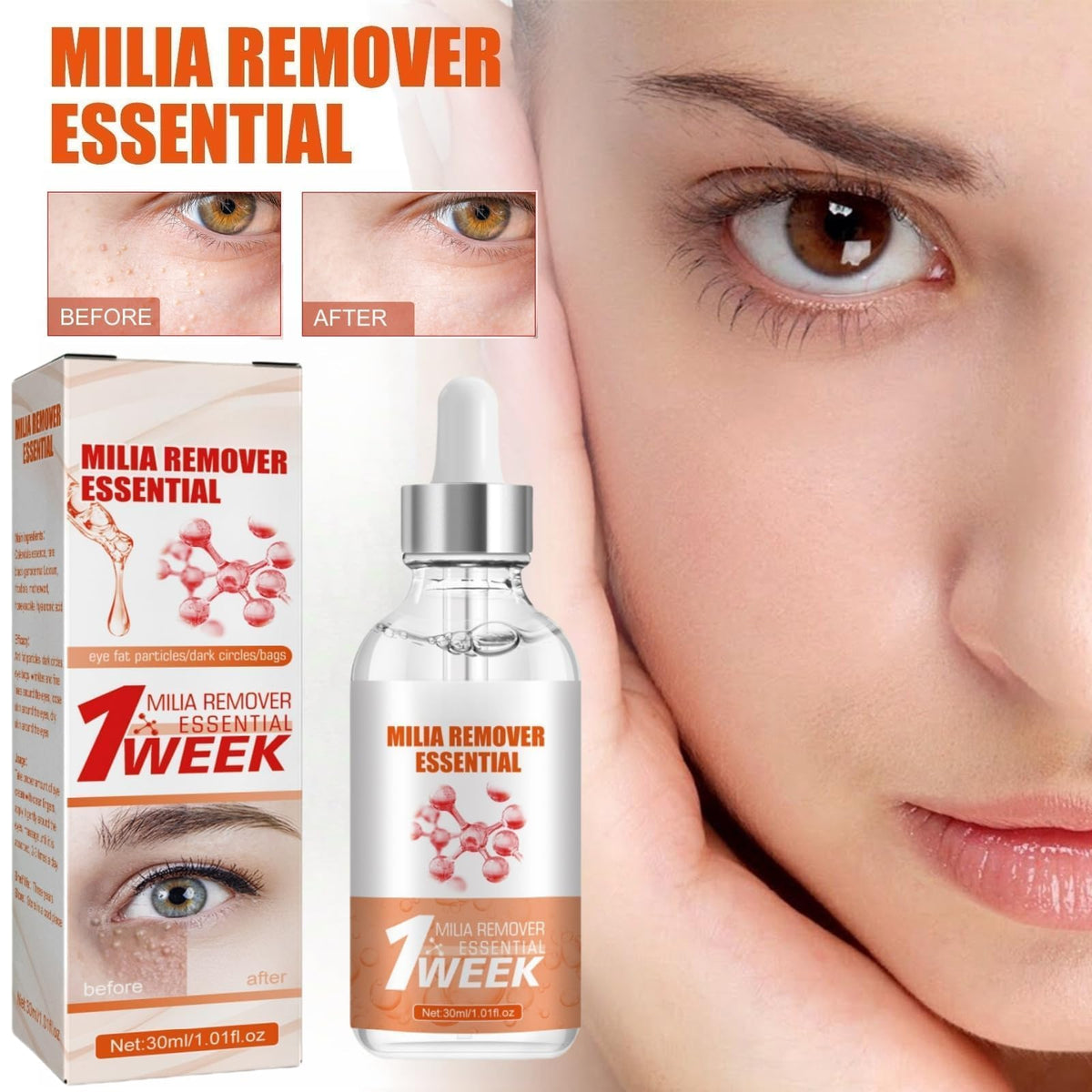 SEMECOMER Advanced Milia Remover Serum – Dual-Action Formula Soothes Milias, Dark Circles, Puffiness & Bags, Brightens & Tightens Under-Eye Area. Milia Removal Anti-Aging Treatment for Saggy Skin