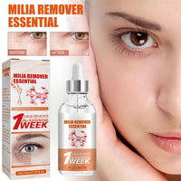 SEMECOMER Advanced Milia Remover Serum – Dual-Action Formula Soothes Milias, Dark Circles, Puffiness & Bags, Brightens & Tightens Under-Eye Area. Milia Removal Anti-Aging Treatment for Saggy Skin