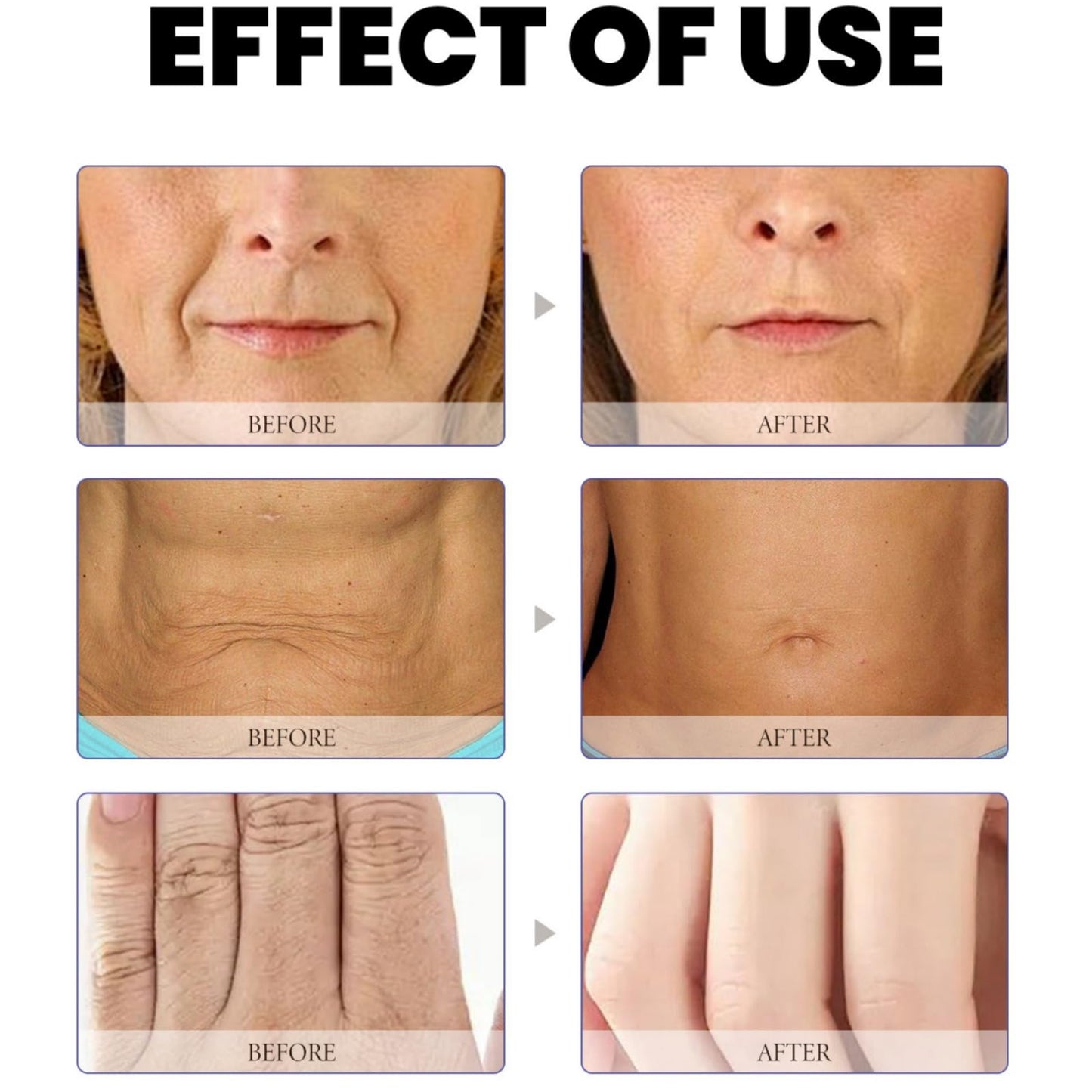 Ruojiar Luxe Collagen Firming Cream,Ultra Firming & Revitalizing Cream,Skin Lifting Wrinkle Removal Cream,Anti-Aging Moisturizer with Collagen,Advanced Firming & Wrinkle Reducing Cream,Collagen Body Lotion