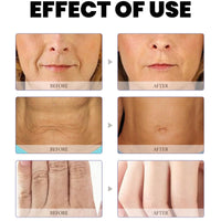 Ruojiar Luxe Collagen Firming Cream,Ultra Firming & Revitalizing Cream,Skin Lifting Wrinkle Removal Cream,Anti-Aging Moisturizer with Collagen,Advanced Firming & Wrinkle Reducing Cream,Collagen Body Lotion