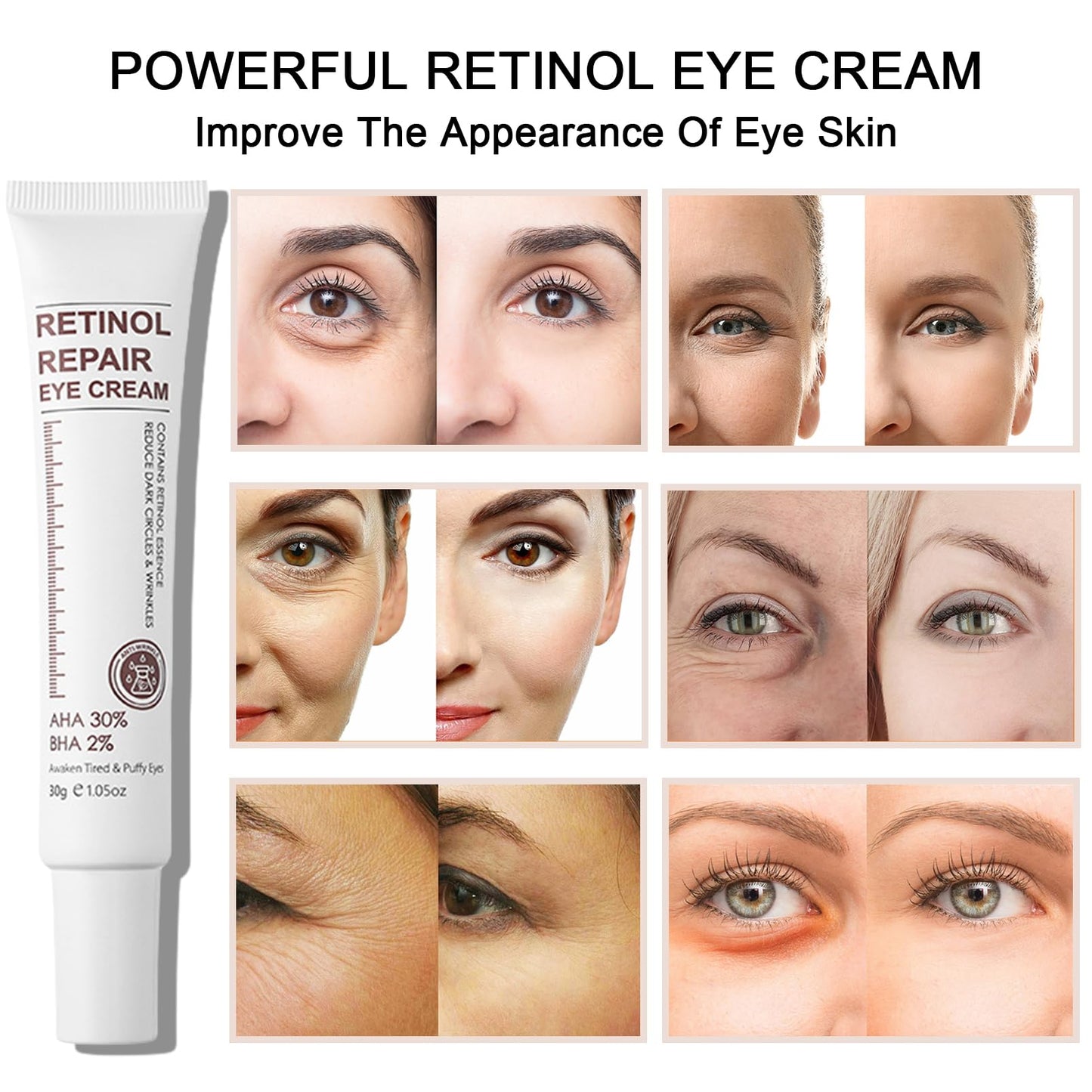 Retinol Eye Cream With Retinol Serum & AHA 30% & BHA 2% -Under Eye Cream For Dark Circles Puffy Eyes -Retinol Serum Moisturising Anti-Wrinkle Anti-Aging Eye Creams (Retinol Eye Cream)