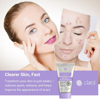 Skin Shop CLAROL Silver Serum 50ml – The First 'Smart' Anti-Bacterial Solution for Acne, Oily Skin, Redness, Scars, and Sensitive Skin