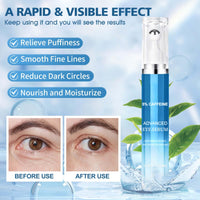 Allony Caffeine Eye Cream, Eye Cream for Dark Circles and Puffy Eyes, Eye Cream Anti Aging, Eye Bags Remover, Moisturizing, Firming and Anti-wrinkle(20ml)