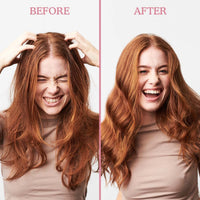 Umberto Giannini Scalp Scrub, Vegan & Cruelty Free Exfoliating Anti-Dandruff Scalp Rescue Scrub