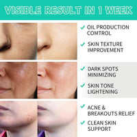 Trendyfave 50 Pads Anti-Aging Glycolic Acid Resurfacing Pads 35%, Glycolic Acid Pads for Face and Body, Exfoliating Face Pads with Vitamins B5, C & E, Green Tea, Glycolic Acid Face Wash for Cleansing Peeling