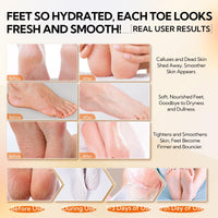LANBENA Vitamin C Foot Peeling Mask, Foot Mask for Dry Cracked Feet, Exfoliator Peel Off Calluses Dead Skin Callus Remover, Repair Rough Heels & Get a Baby Soft Feet for Men and Women(2 Pairs)