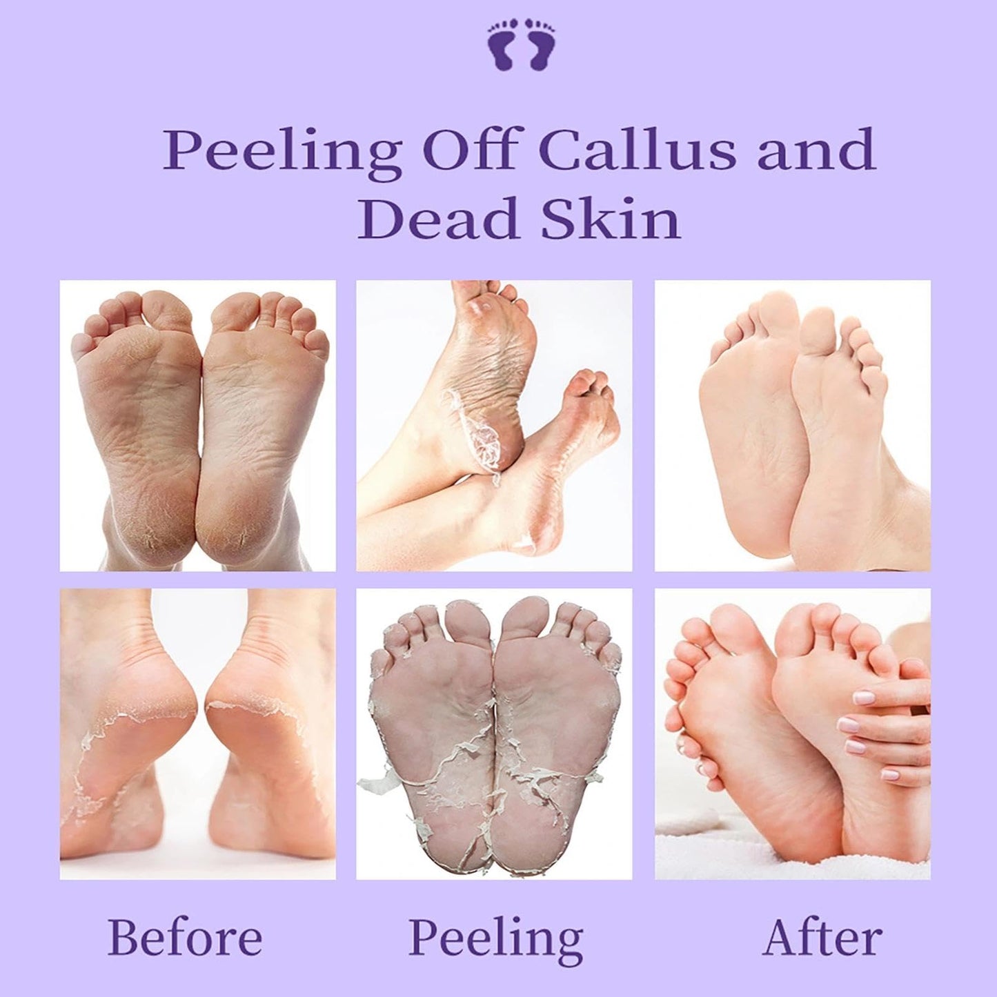 OlymGrow 2-Pack Foot Peel Mask – Callus Remover & Exfoliator for Soft, Smooth Feet, Repair Cracked Heels, Remove Dead Skin, Peeling Foot Mask for Hard, Dry Skin