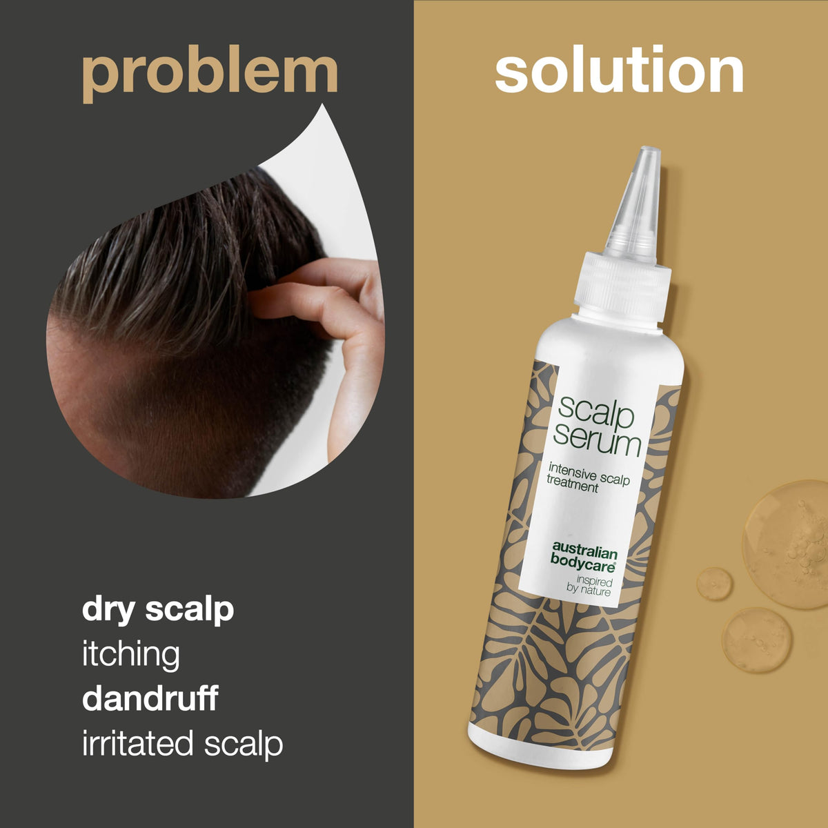 Scalp Treatment Products from Australian Bodycare for Dry, Itchy, Flaky Scalp & Hair, Dandruff, Spots & Pimples | Daily Care for People with Eczema or Psoriasis | Hair Cleanser for Men & Women (150ml)
