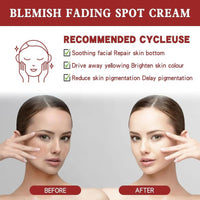 Dark Spot Remover Face Creams,Dark Spot Remover for Face & Body,Pigmentation Treatment,Age Spot Cream,Whitening Freckle Cream,Sun Spots and Melasma Treatment Creams,Fade Freckles & Improve Dull Skin