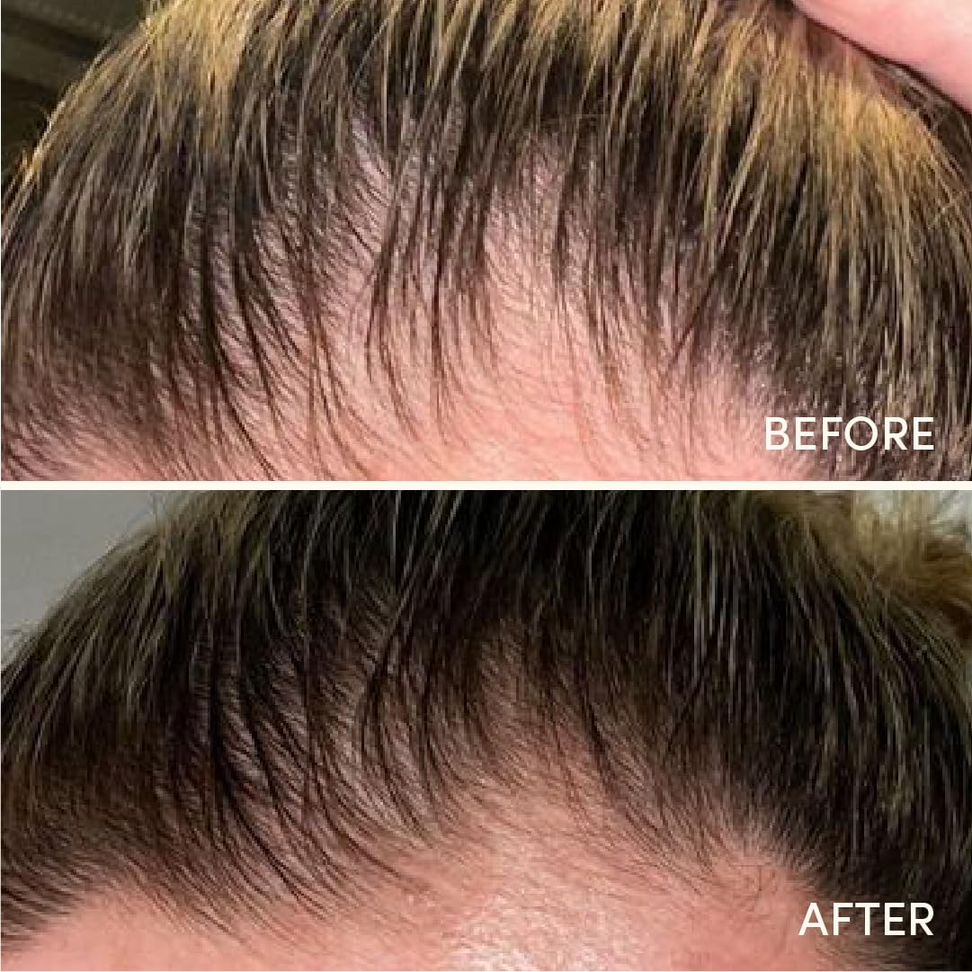 Glow for it Glow For It - Hair Growth Serum 50ml | Promotes Fuller and Thicker Growth | For Thinning, Weak Hair Or Slow Growth | Water Based Serum | Nourishes Scalp Without Greasy Residue