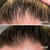 Glow for it Glow For It - Hair Growth Serum 50ml | Promotes Fuller and Thicker Growth | For Thinning, Weak Hair Or Slow Growth | Water Based Serum | Nourishes Scalp Without Greasy Residue
