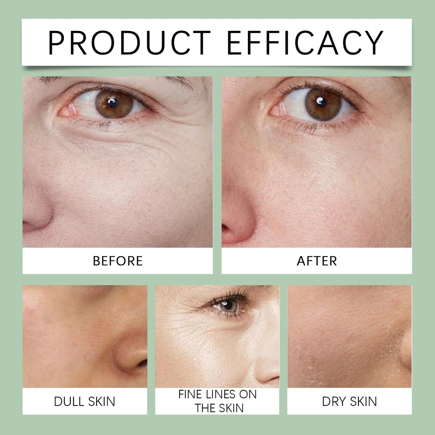 Siyinzu Skin Tightening Cream for Face,Anti Wrinkle Face Cream,Instant Face Lift Cream,Day and Night Cream for Women,Skin Firming Cream Serum for Women,Skin Cream for Loose Skin,Hyaluronic Acid Moisturizer