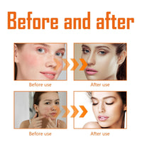 Face Toner - Turmeric Toner for Face - Face Care for Hydrating,Repairing,Anti-Aging - Natural Turmeric Essence Skincare Toner - Moisturizing,Soothing,Brightening Facial Toner