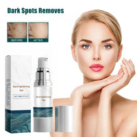 Spot-lightening Gel,Skin Tightening Cream,Skin Brightening Face Serum for Discolouration and Hyperpigme/ntation,Vitamine C&Hyaluronic Acid Face Serum,Face Brightening Serum,for All Skin Types,30ml
