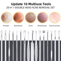 AIBEE 10 Pcs Blackhead Remover Pimple Popper Tool Kit,Comedone Extractor Tools for Acne, Blackhead,Whitehead,Pimples,Spot,Zit Removal Tool on Nose Face Skin