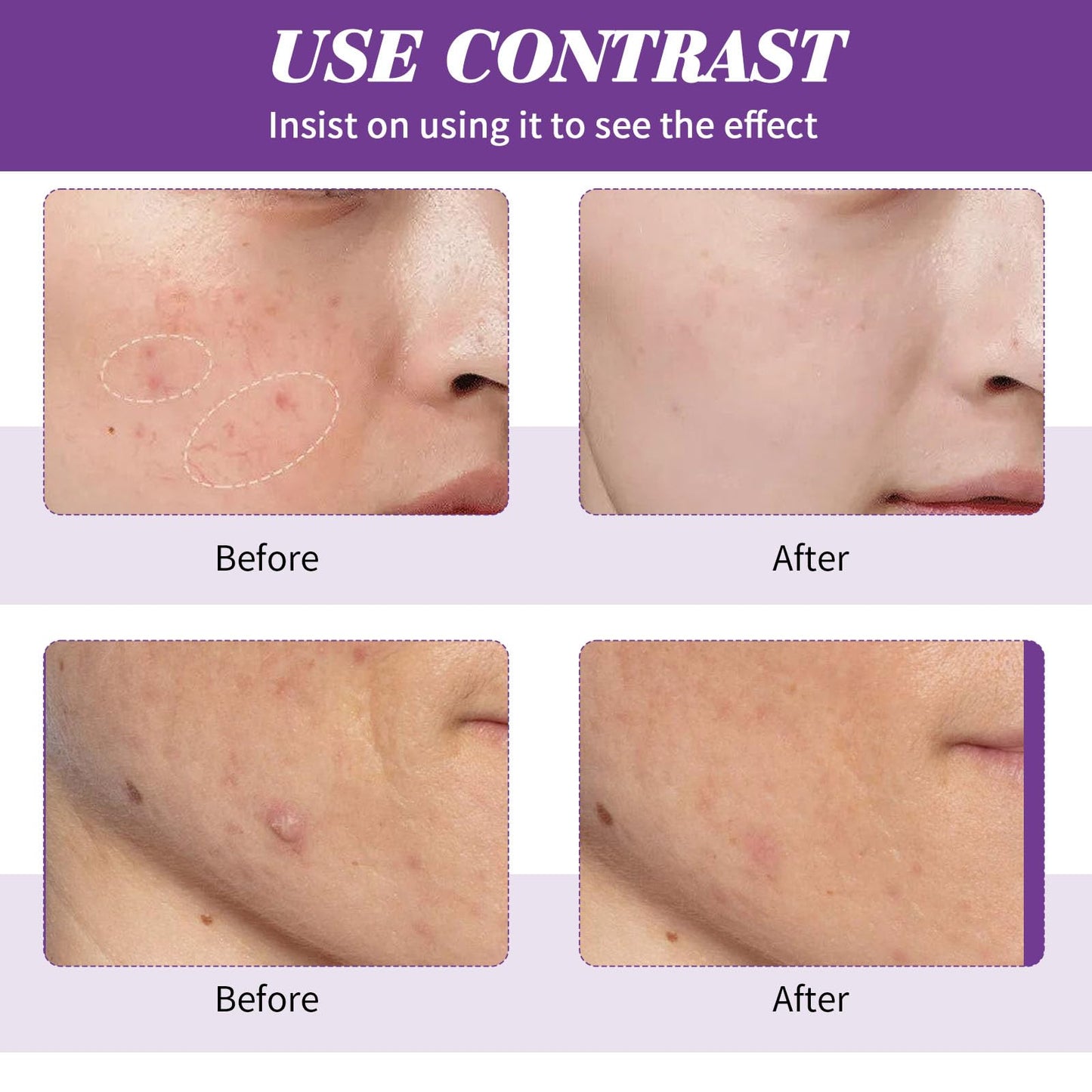 Azelaic Acid Cream,Azelaic Acid Face Cream,Azelaic Acid Serum,Azelaic Acid 12% Facial Serum,Facial Serum Cream,Niacinamide & Vitamin C Face Cream,For All Skin Types (20g)