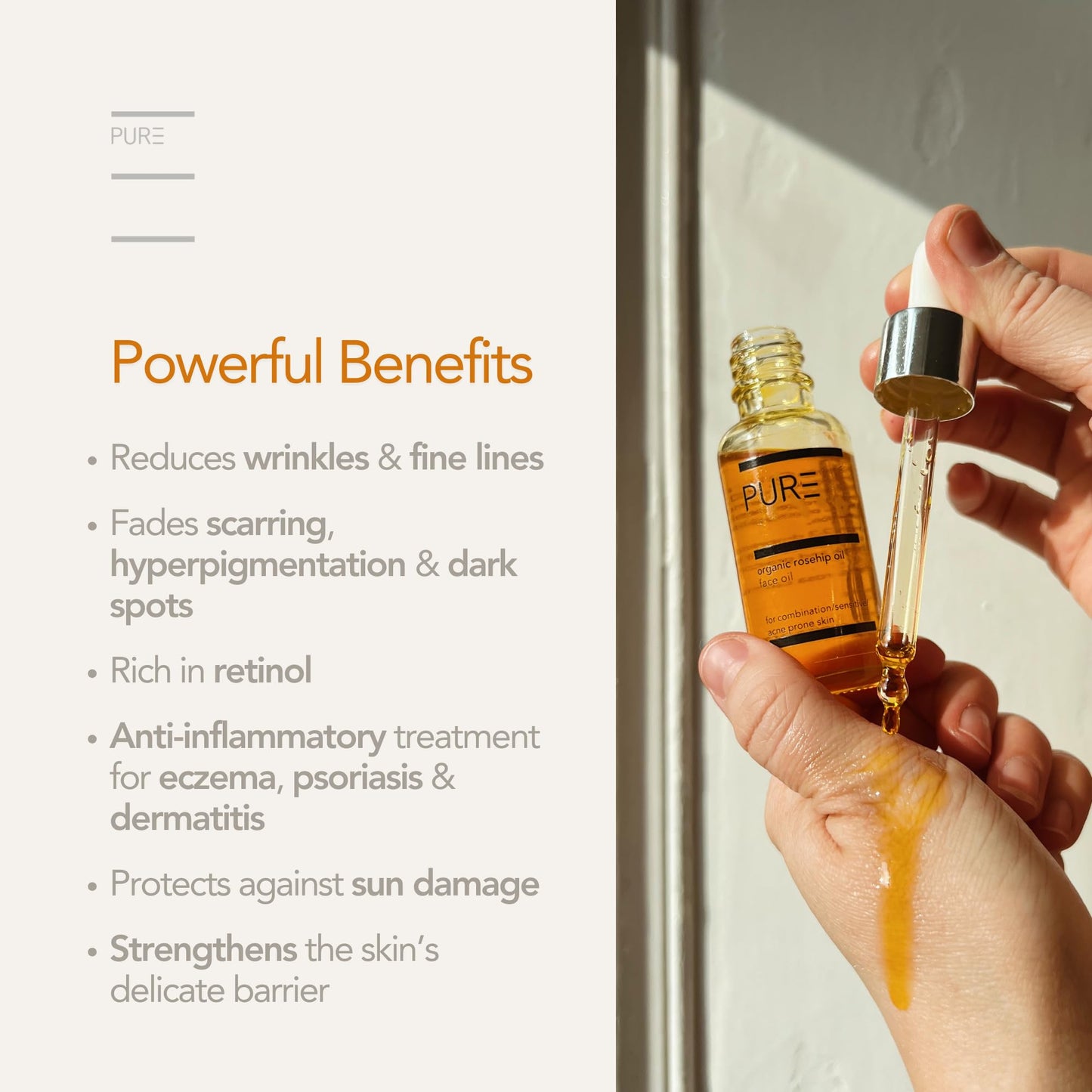 Organic Cold-Pressed Rosehip Face & Body Oil by PURE Spa Skincare - 30ml - 100% Pure, Natural & Vegan - Anti-Ageing, Smoothing, Nourishing, Rejuvenating - For All Skin Types and Fine Lines & Scars