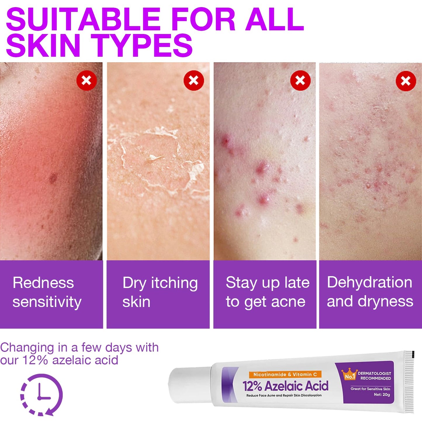 XdealCozyxc 2 PCS The Ordinary Azelaic Acid Serum, Azelaic Acid Cream Brightening Face Skin Care Pigmentation Treatment for All Skin Types