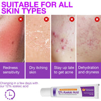 XdealCozyxc 2 PCS The Ordinary Azelaic Acid Serum, Azelaic Acid Cream Brightening Face Skin Care Pigmentation Treatment for All Skin Types