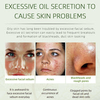 QEUTKEZS Herbal Acne Removing Cream,Professionally Remove Acne Marks,Gently Moisturize,Refreshing & Not Greasy,Improving Sensitive Skin Prone to Acne,Acne Scar Cream & Pimple Remover For All Skin Types
