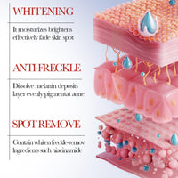Ruojiar Freckle Removal Cream,Dark Spot Remover for Face and Body,Dark Spot Corrector Freckle Remover,Skin Brightening Cream,Moisturizing Anti-blemish Cre/am,Da/rk Spot Correcting Glow Serum,Spot Cre/am