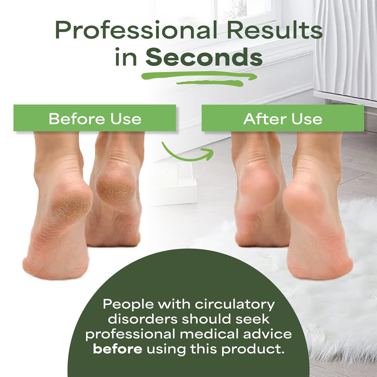 Pedi-wise PEDI-WISE Double Sided Foot File - Extra Large Professional Foot Rasp for Hard Skin Removal - Concave/Convex Shape for Maximum Efficiency - Recommended by Podiatrists - Twin Pack