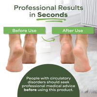 Pedi-wise PEDI-WISE Double Sided Foot File - Extra Large Professional Foot Rasp for Hard Skin Removal - Concave/Convex Shape for Maximum Efficiency - Recommended by Podiatrists - Twin Pack