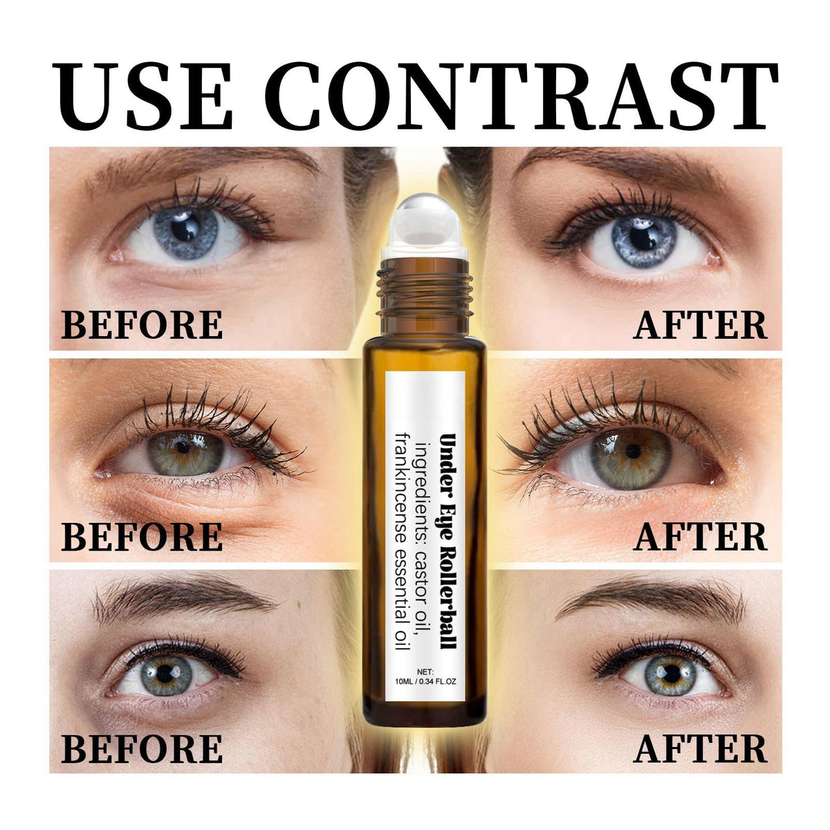 HIVETZ Rollerball Castor Oil,Castor Oil and Frankincense Eye Roller,Castor Oil Eye Roller Serum,Eye Cream for Dark Circles and Puffy Eyes,Eye Cream Anti Aging Skincare,Eye Bags Remover,Firming Eye Cream