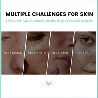 MEITREND Melasma Treatment For Face,Dark Spot Remover for Face & Body, Pigmentation Removal Cream,Corrector For Age Spots Sun Spots Freckles Melasma Brown Spots,Freckle Removal Cream