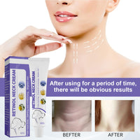 Neck Firming Cream,Strengthen Neck Cream,Neck Firming Cream Tightening Lifting Sagging Skin,Aging Skin & Saggy Skin,Anti Aging Neck Cream,Reduce Wrinkles & Smoothing Neck Fine LIines-Neck&Body
